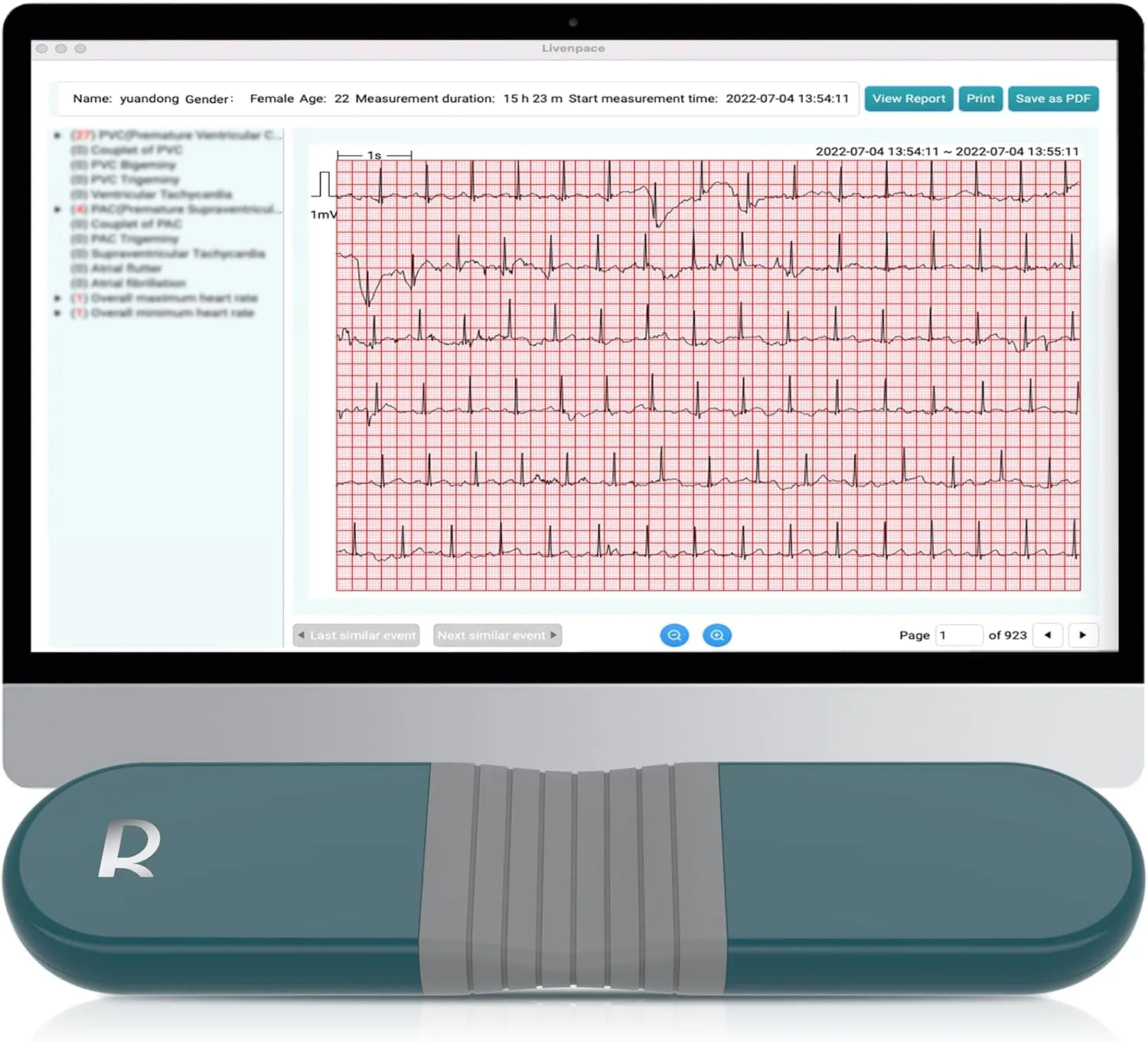 AI HR Monitor, 24 Hours Chest Lead Device with Free AI Analysis & PC Report, Chargeable Recorder, HHM1