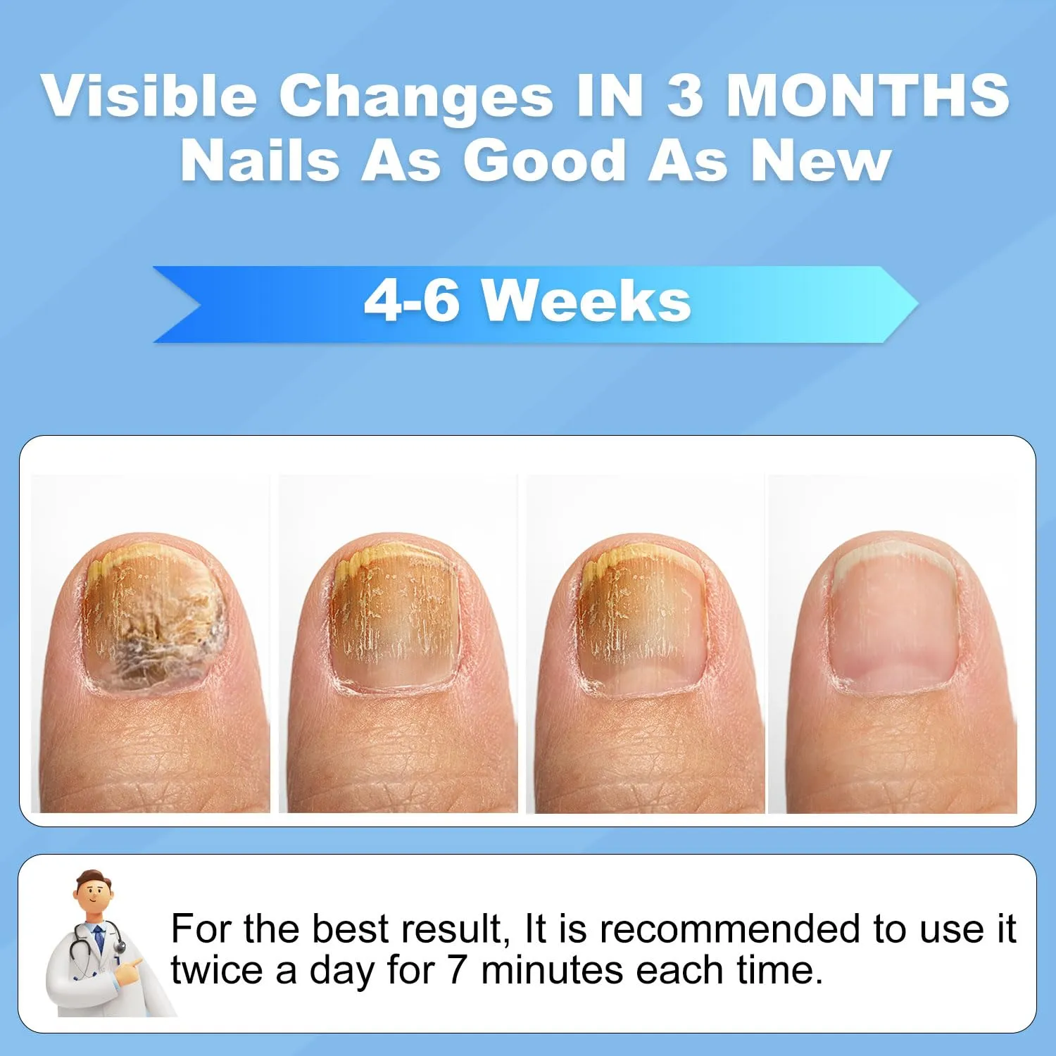 Nail Fungus Laser Treatment Device -Pain-Free, and Effective Home Treatment, No More Embarrassment