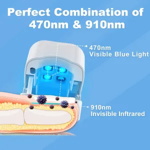 New Nail Fungus Laser Treatment Device for Toenails & Fingernails, Home Use Toenail Fungus Laser Device for Onychomycosis, Effective & Reliable (White)