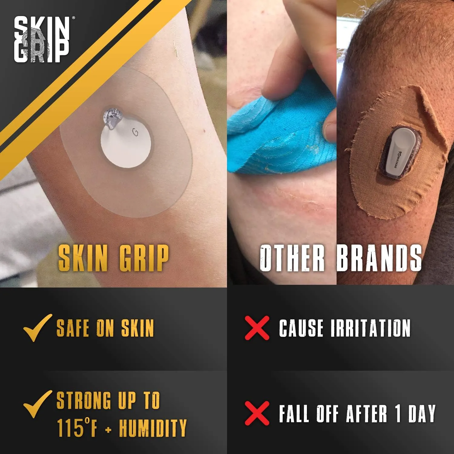 Skin Grip CGM Sensor Patches Compatible with Medtronic Guardian (20-Pack), Waterproof & Sweatproof for 10-14 Days, Pre-Cut Adhesive Tape, Continuous Glucose Monitor Patch, Clear